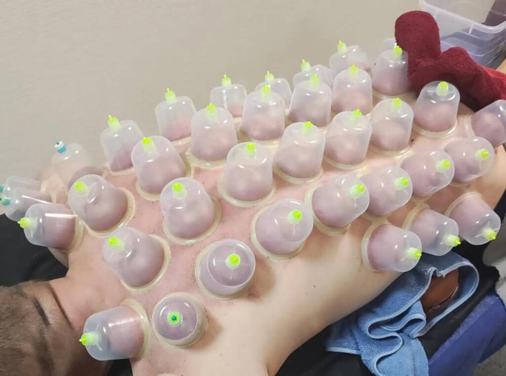 Ventuză Terapeutică Nr.8 din Plastic si Cauciuc - imaginea 4
