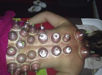 Revitalizați-vă Practica cu Terapia Vacuum